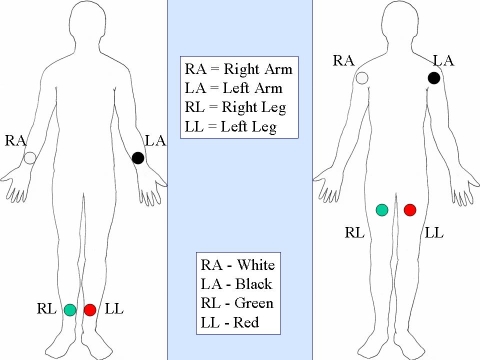 File:Limb Leads.jpg