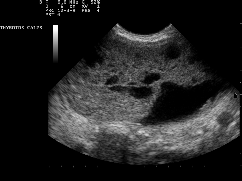 File:Ultrasound Scan ND 0124141638 1428010.png