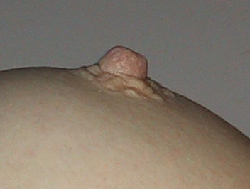 File:Adult Female Left Breast And Nipple.png - Wikimedia Commons