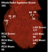 Lesion specific calcium score Lesionspecificcalciumscore.png