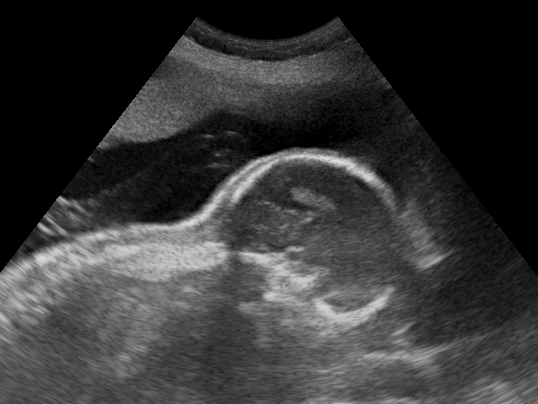 File:Ultrasound Scan ND 145330 1458140 cr.png