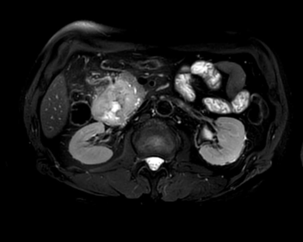 Applied Sciences | Free Full-Text | Beyond the Calcium Score: What  Additional Information from a CT Scan Can Assist in Cardiovascular Risk  Assessment?