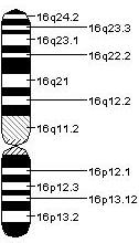 Trisomy 16 Partial or complete triplication of chromosome 16