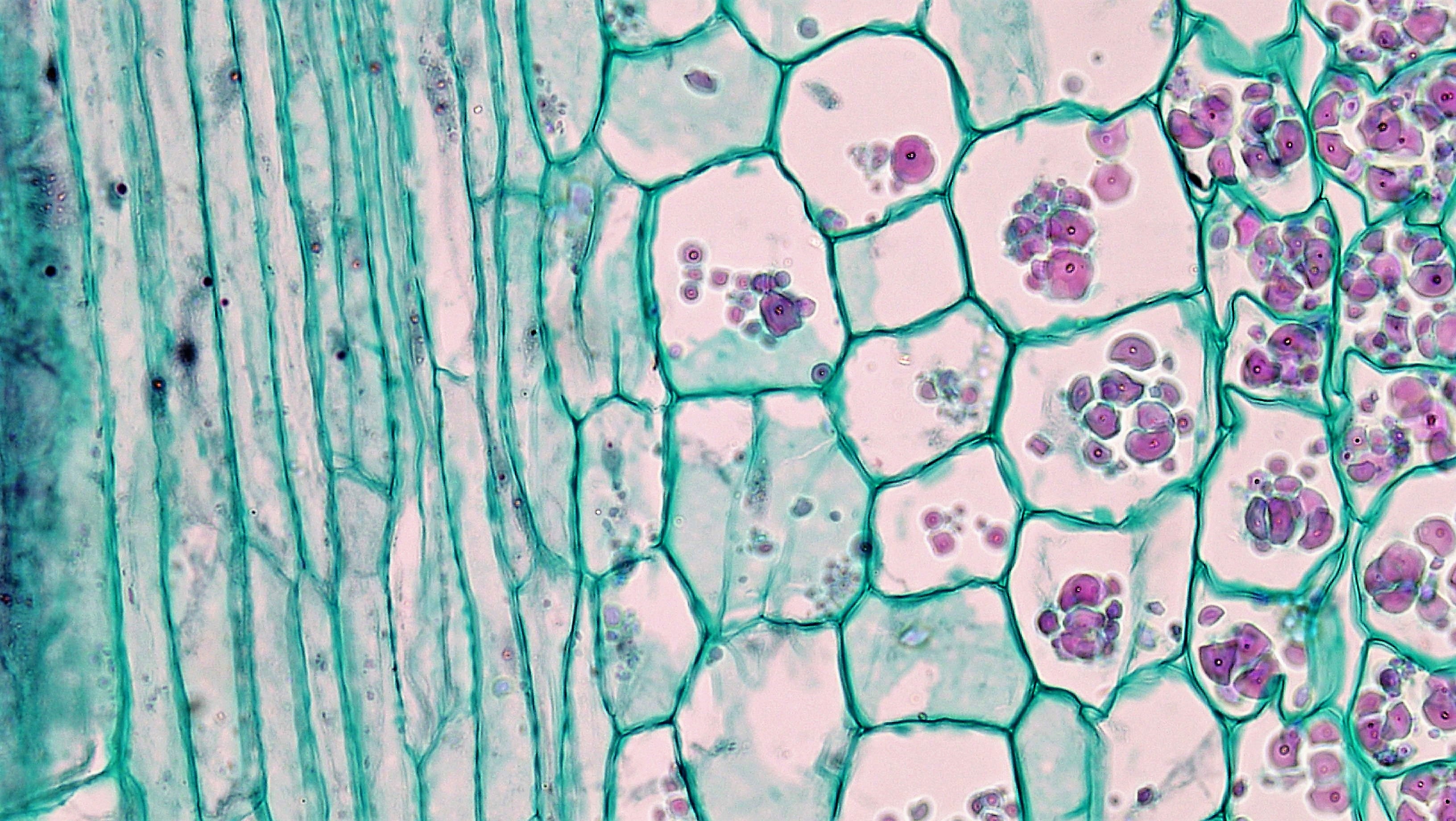 Три группы клеток. Parenchyma Cells. Паренхимные клетки. Рахитическая ар. Клетка.