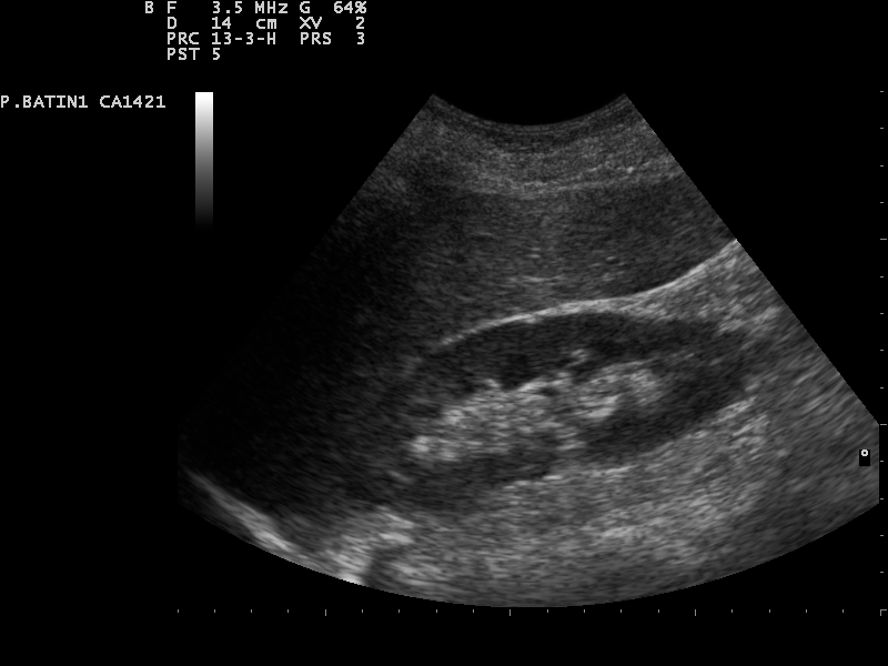 File:Ultrasound Scan ND 0128134059 1344410.png