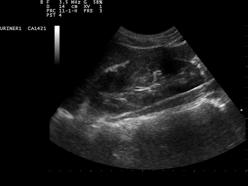 File:Ultrasound Scan ND 0112115321 1155020.png