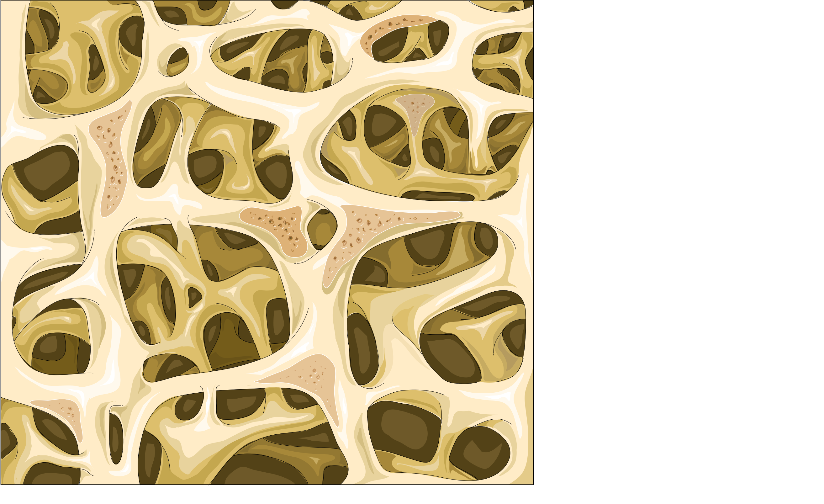 trabecular bone osteoporosis