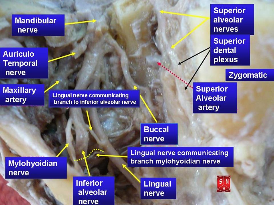 Mandibular nerve (CN V3), Encyclopedia, , Learn anatomy