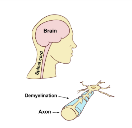 File:Central Nervous System.png - Wikipedia