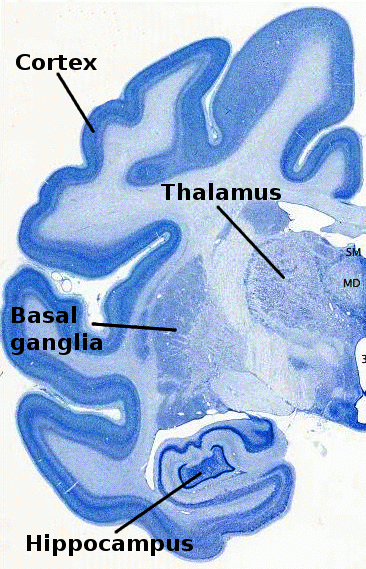 Cerebral cortex - Wikipedia