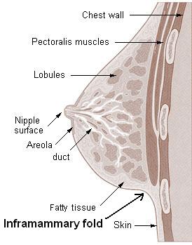 Diagram of the ductal anatomy of the breast. (1) Chest wall, (2