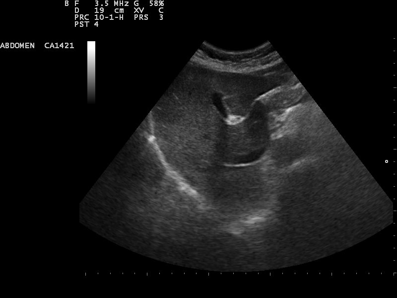 File:Ultrasound Scan ND 0112145550 1459330.png