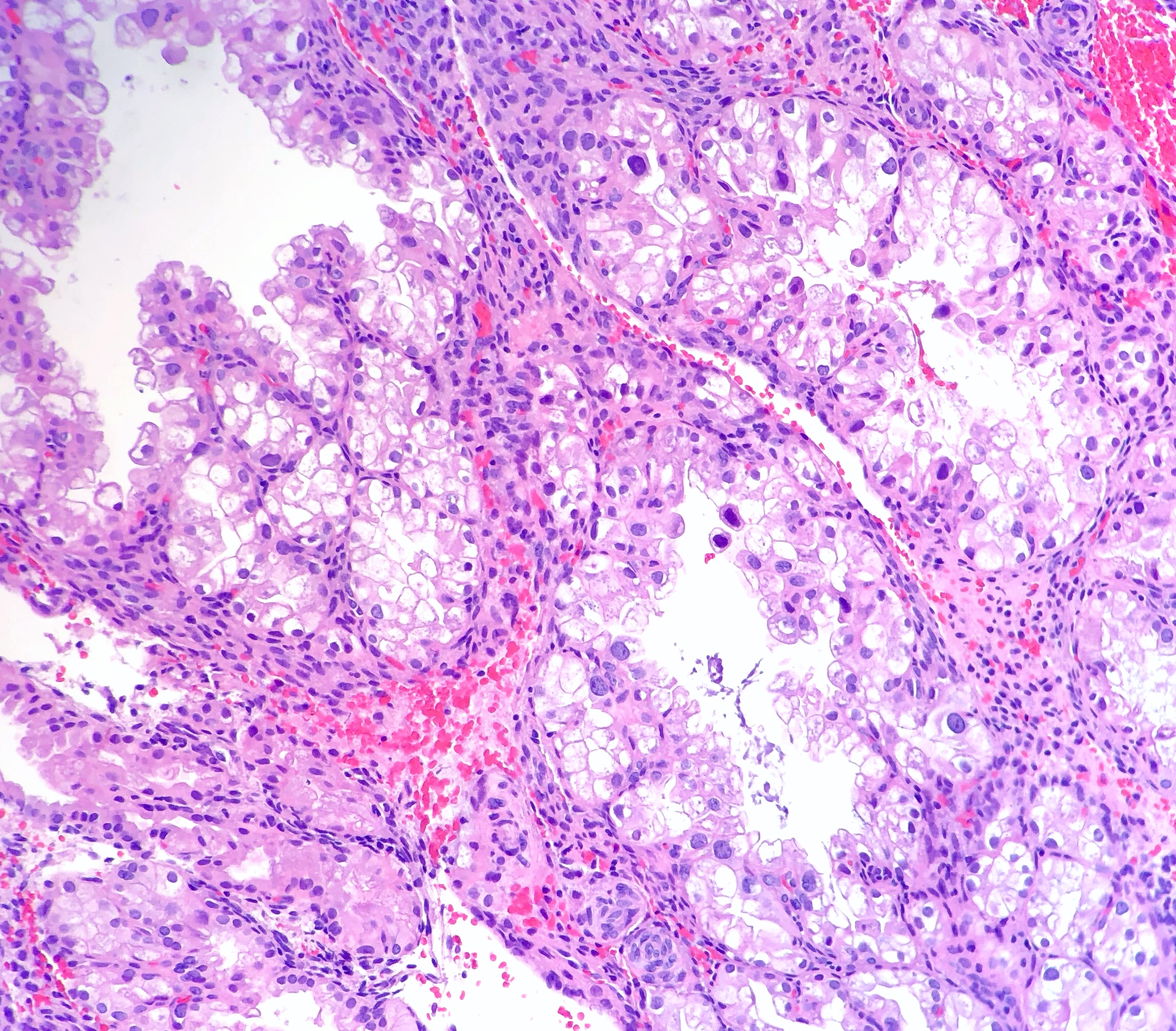 Pathology secretory endometrium Pathology Outlines