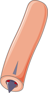 File:Cardiovascular system - Vasoconstriction 3 -- Smart-Servier.png