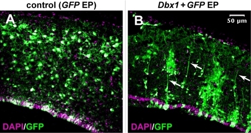 File:Changes in radial fiber projection patterns of migrating neurons by Dbx1-misexpression - journal.pone.0001454.g007 A+B.jpg