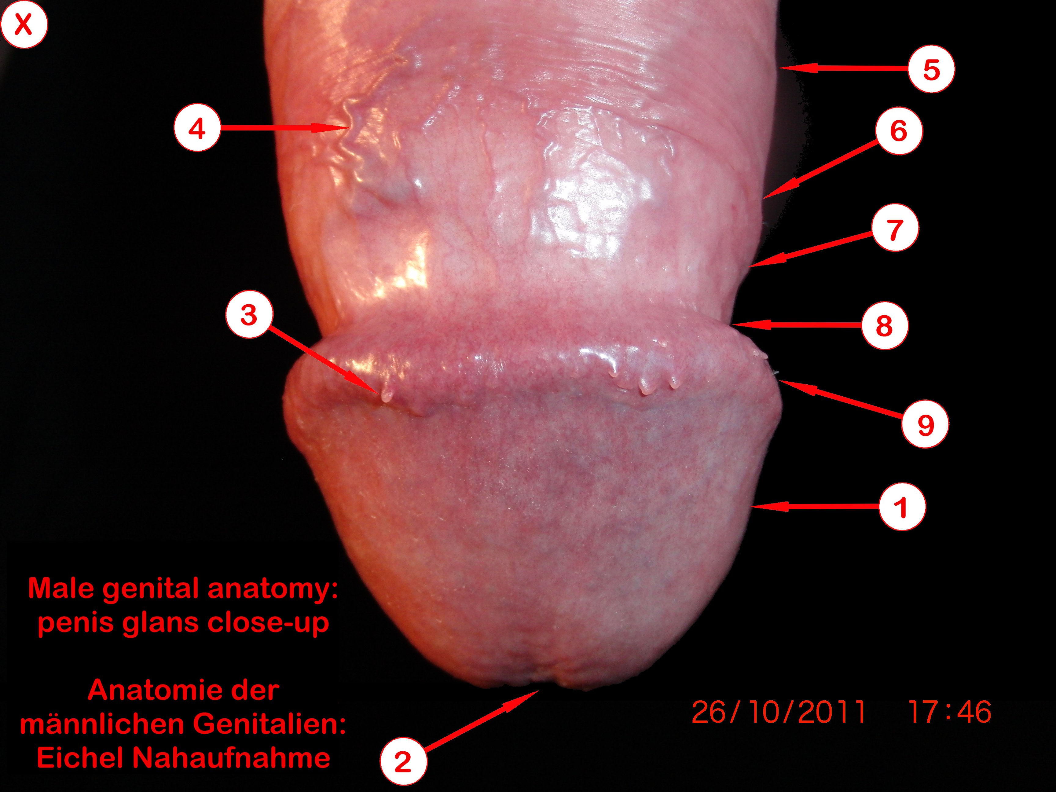 Male genital anatomy - penis glans close-up (Anatomie der männlichen Genita...