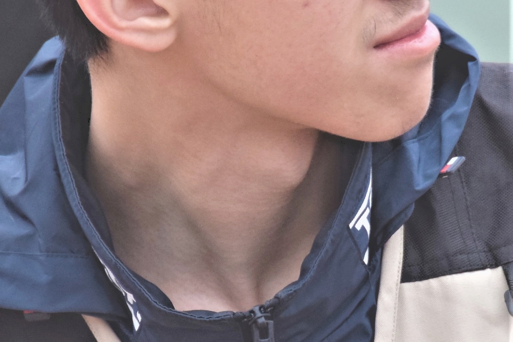 Adam s apple