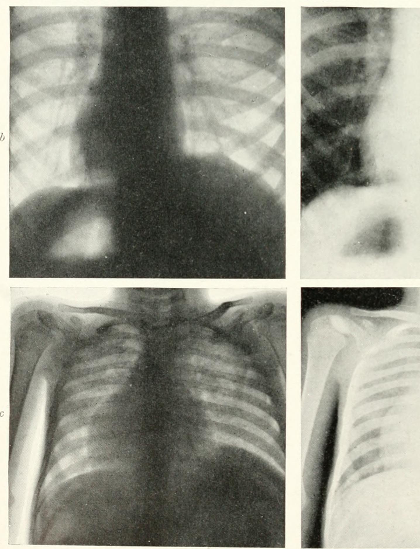 Radiography, x-ray therapeutics and radium therapy (1915) (14757632645).jpg