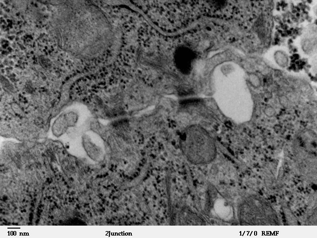 File:Two desmosomes - TEM.jpg