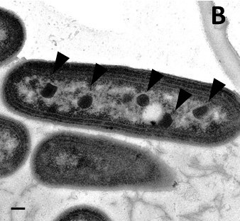 File:Alpha and beta carboxysomes-B.jpg