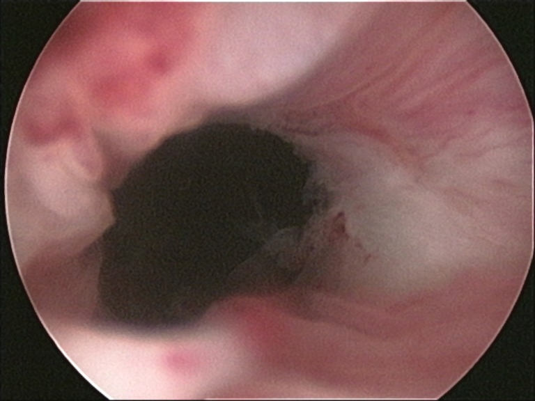 File:Cervix uteri 1.jpg