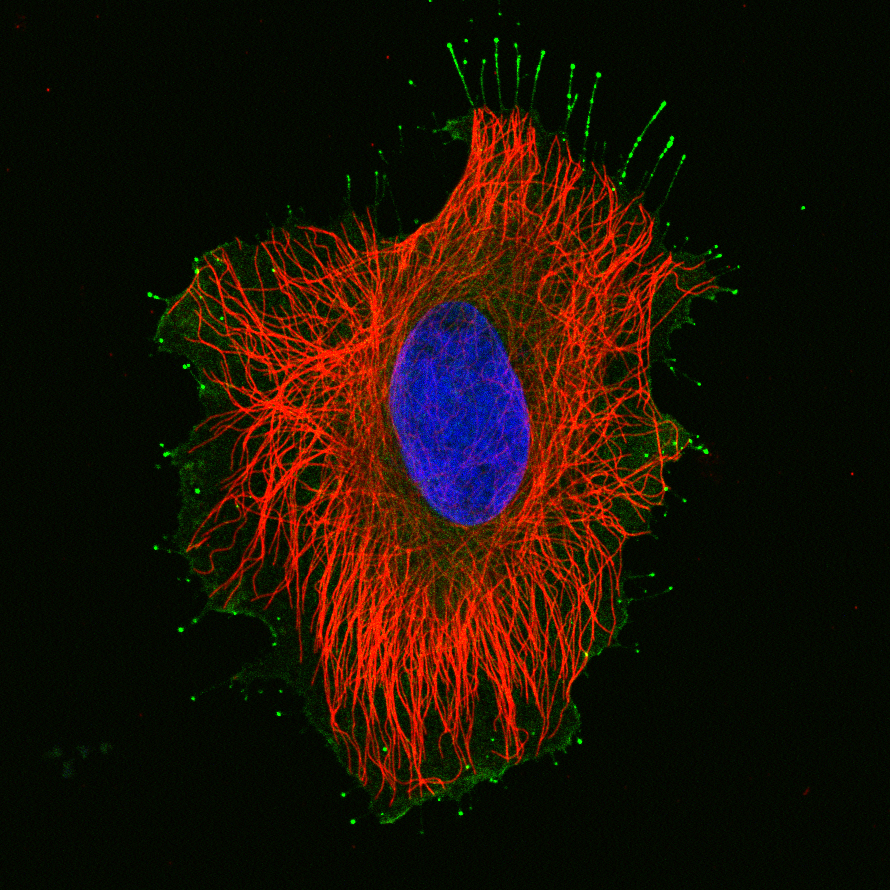 Color image of a HeLa cell