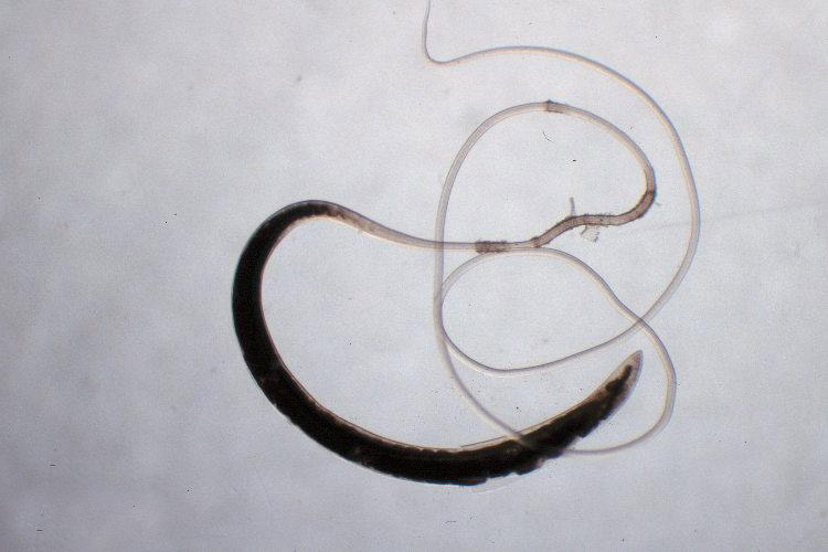 File:Trichuris-adult.jpg