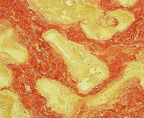 <span class="mw-page-title-main">Van Gieson's stain</span>