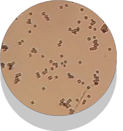 File:Bacterias al microscopio óptico.jpg