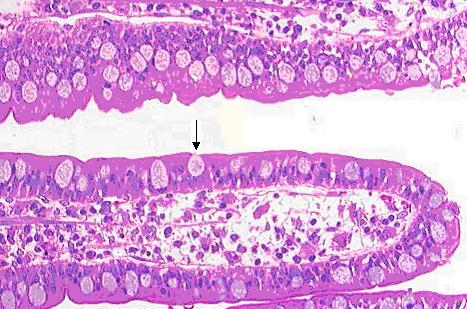 Goblet cells in the wall of an ileum vili. At its sides, enterocytes are visible over a core of lamina propria.