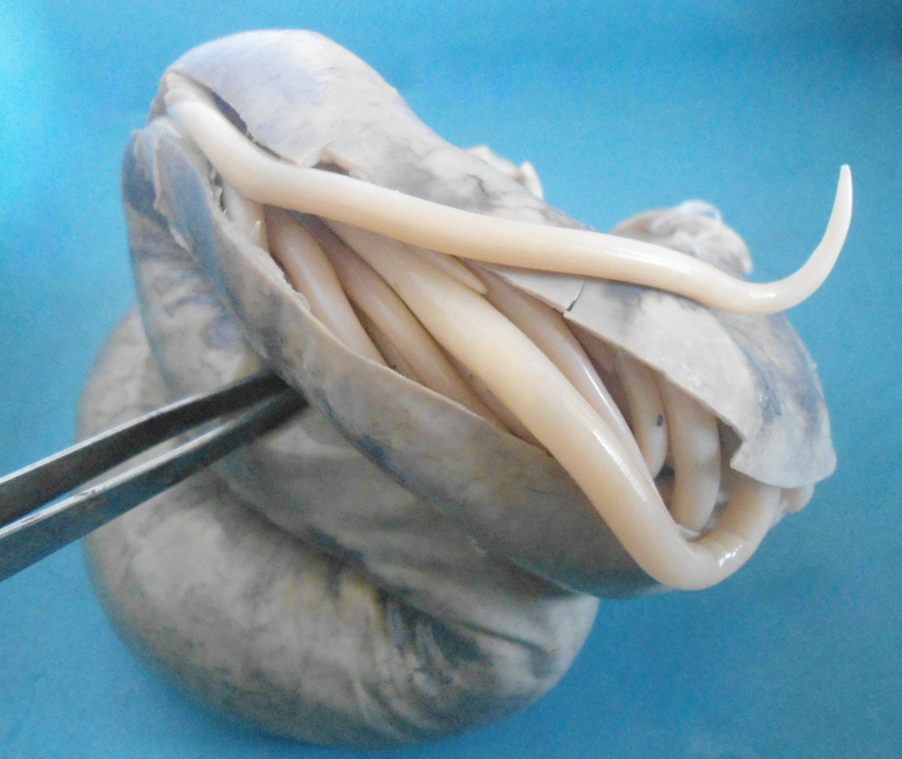 File:Ascaris lumbricoides (Round worm).JPG - Wikimedia Commons