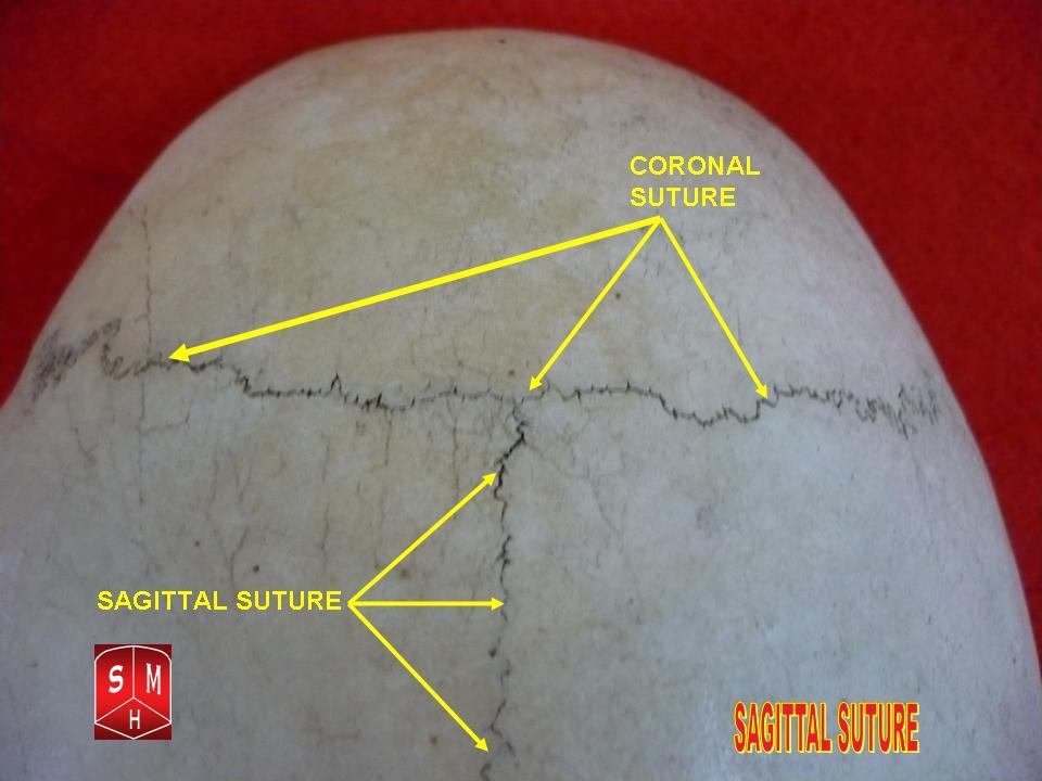 sagittal suture