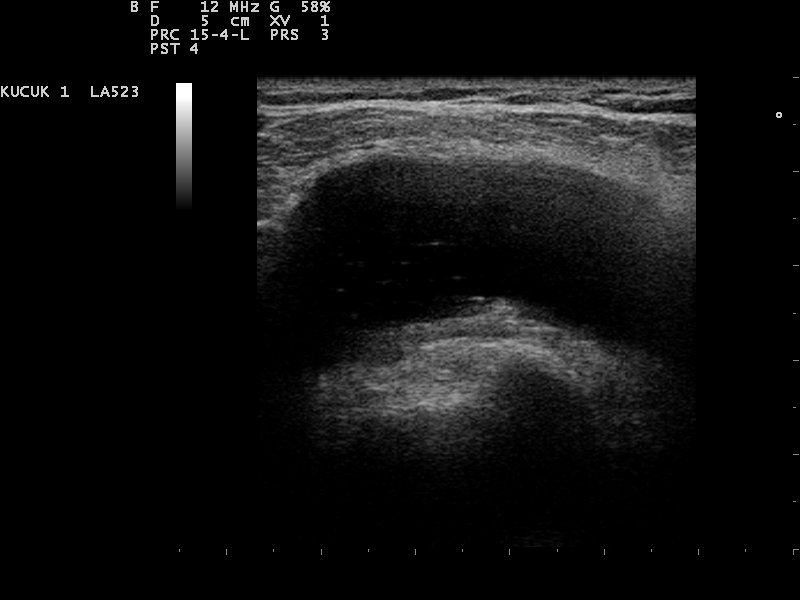 File:Ultrasound Scan ND 110215104419 1047310.jpg