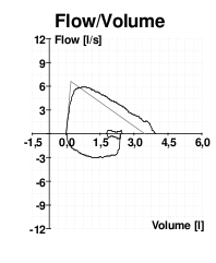 File:Bad spirometry flow volume curve.png