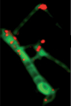 <span class="mw-page-title-main">Scanning transmission X-ray microscopy</span>