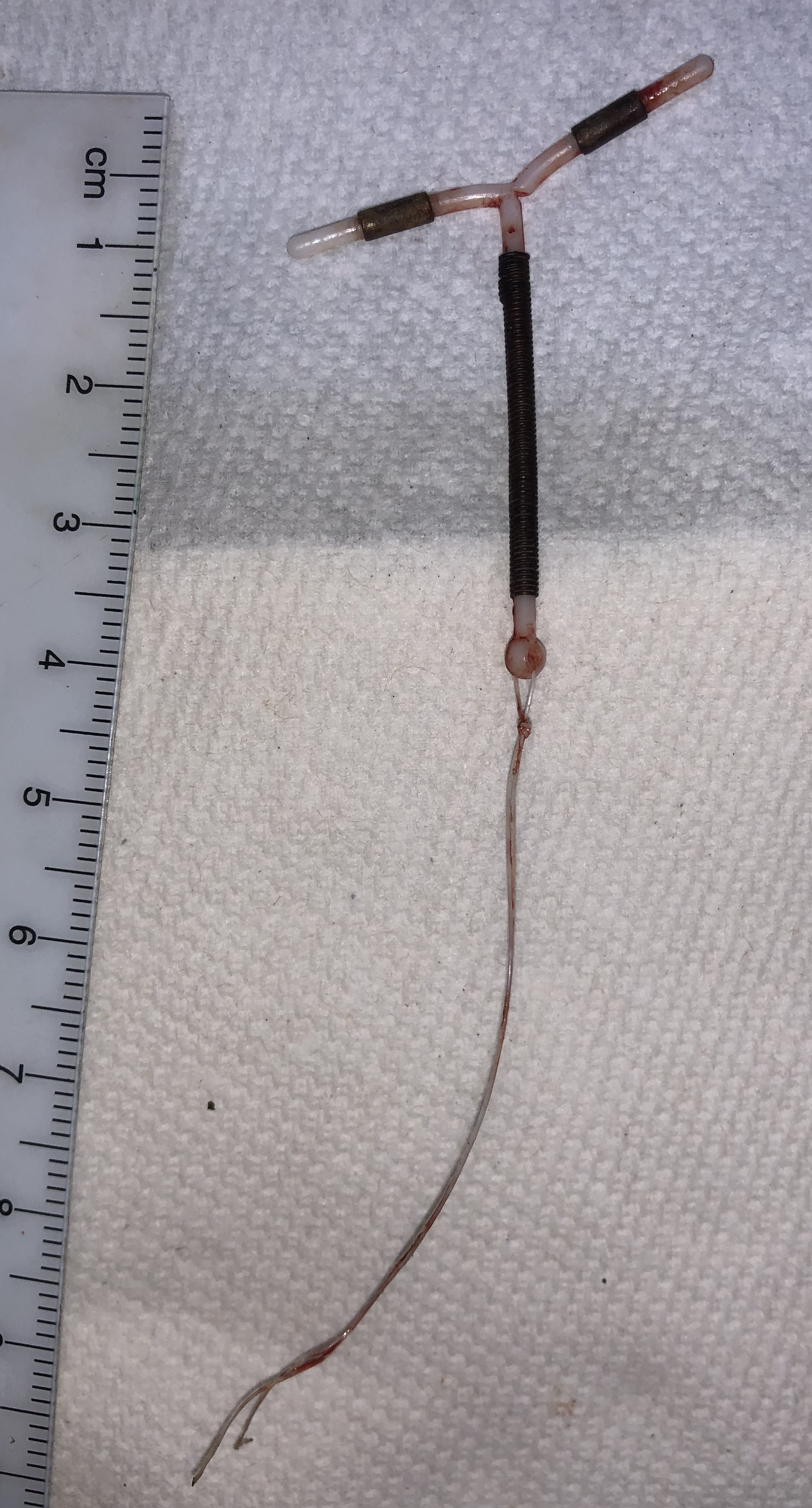 copper iud