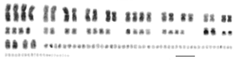 File:Karyotype of North American paddlefish (Polyodon spathula).png