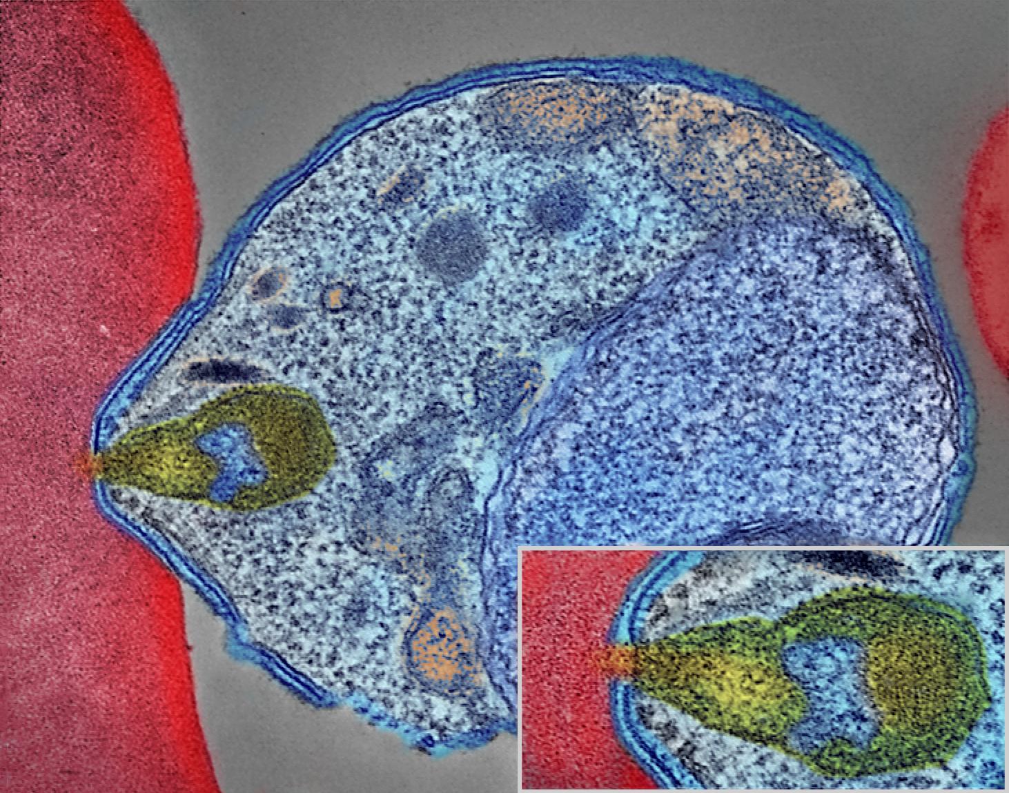 Malaria Parasite Connecting to Human Red Blood Cell (34034143483).jpg