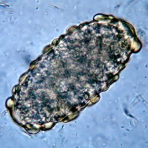 Unfertilized Ascariasis Egg