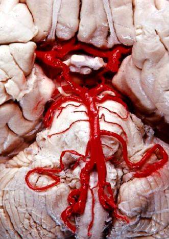 File:Human brainstem blood supply.JPG