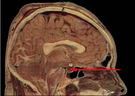 File:Pituitary gland.png