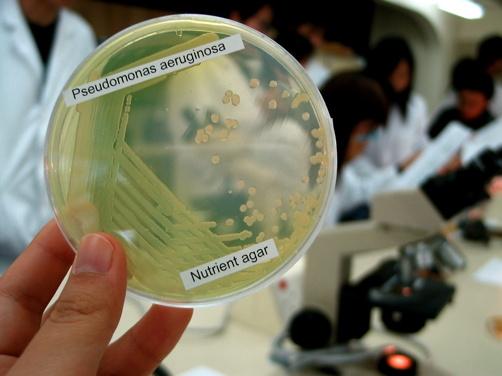 Chloronychia caused by Pseudomonas oryzihabitans infection - ScienceDirect