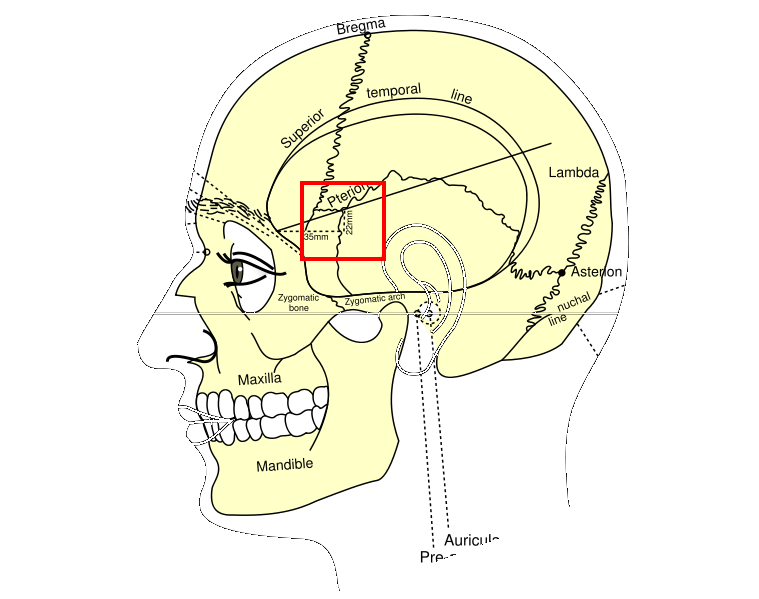 Pterion - Wikipedia