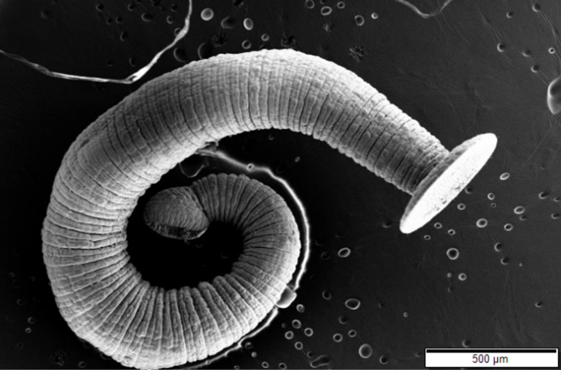 https://upload.wikimedia.org/wikipedia/commons/6/6a/Tapeworm_SEM2.jpg