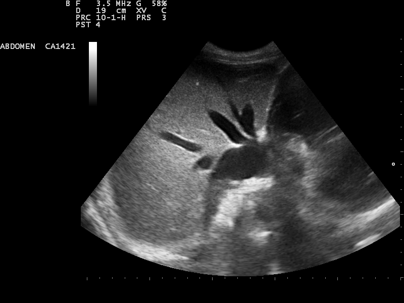 File:Ultrasound Scan ND 0104134930 1356510.png