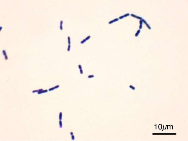 File:Bacillus cereus Gram.jpg