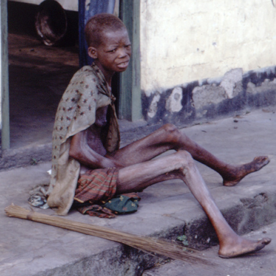 File:Starving woman africa biafra nigeria conflict famine (cropped).jpg