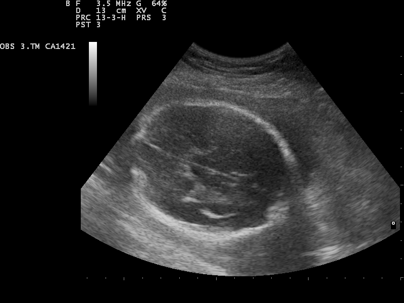 File:Ultrasound Scan ND 0128154150 1544190.png