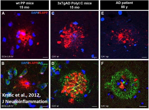 File:Systemic Inflammation AD 03.jpg