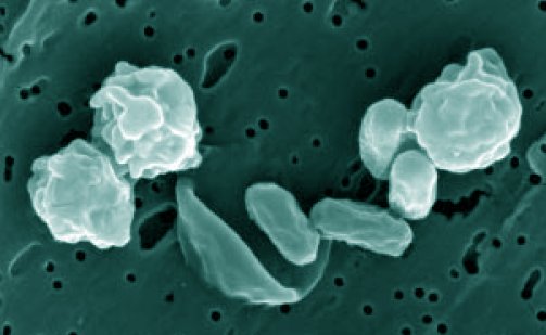 File:Bacillus odysseyi.jpg